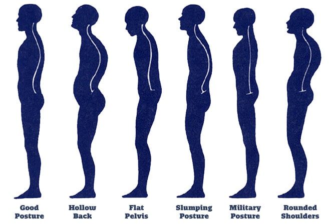 How_to_fix_posture