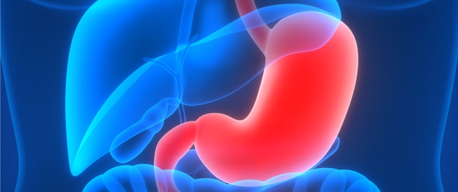 عملية تكميم المعدة Gastric Sleeve واحدة من أكثر جراحات السمنة شهرة، والأكثر تفضيلًا بين المرضى والأطباء، نظرًا لما تتميز به من تكنيك سهل